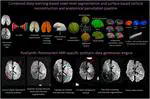 Cortical reconstruction and anatomical parcellation of high-resolution multi-modal postmortem ex vivo MRI of the human infant brain